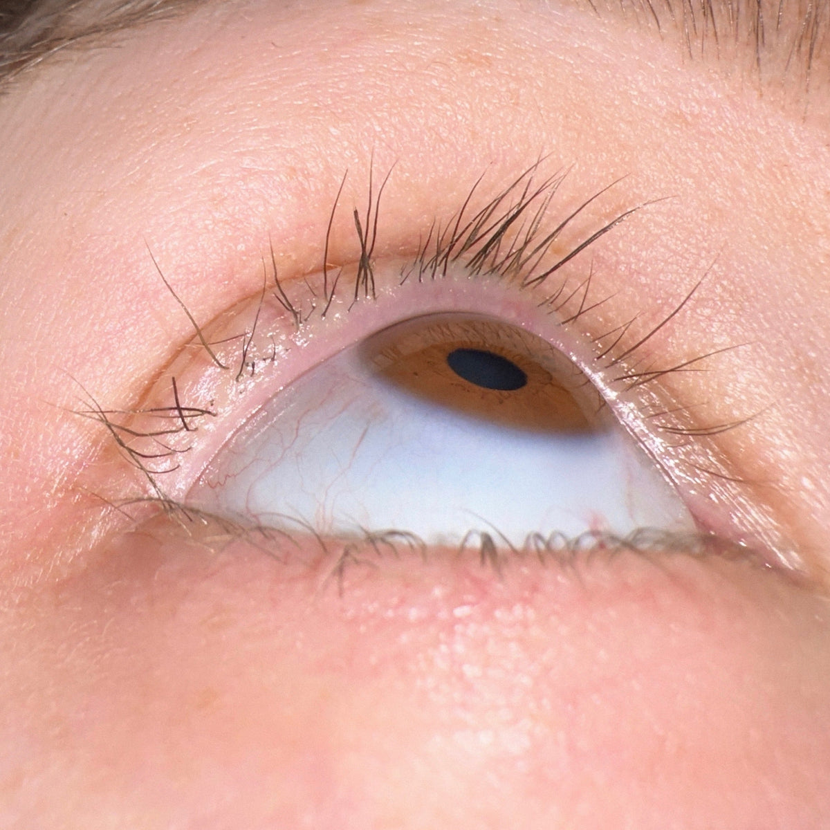 Close-up of an eye before using the lash serum, with sparse, short lashes