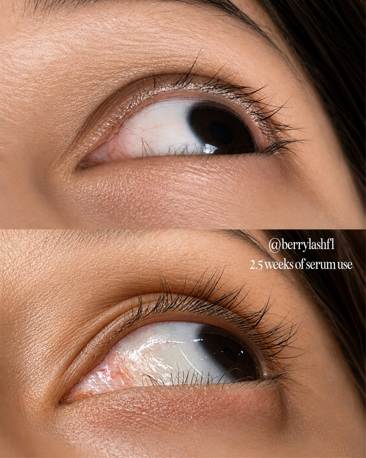 Close-up of an eye with a before and after comparison of eyelash growth, showing 2.5 weeks of serum use.