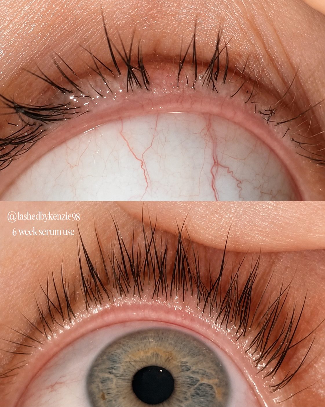 Close-up before-and-after comparison of eyelashes, with the top panel showing sparse, weak lashes and the bottom panel showing fuller, darker, and healthier lashes. A watermark reads '@lashedbykenzie98 6 week serumuse'.