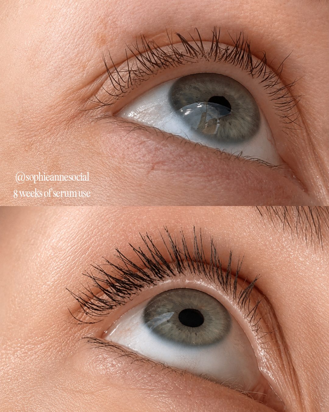 Light Heart lash serum before and after, eight weeks of nightly use
 Close-up before-and-after comparison of a person's eye showing the effect of a serum on eyelashes. The top image shows shorter, sparser lashes, while the bottom image shows significantly longer, darker, and more defined lashes.