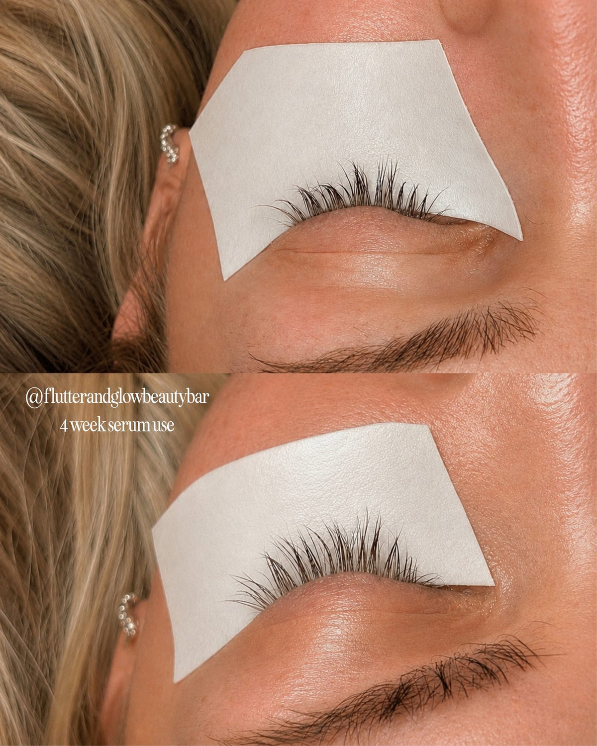 Natural lashes under extensions after four weeks of serum use and proper cleansing